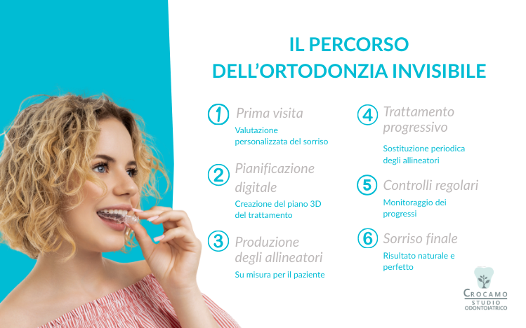 il percorso dell'ortodonzia invisibile