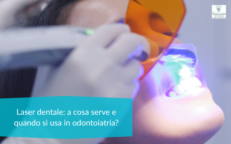 immagine di copertina: laser dentale